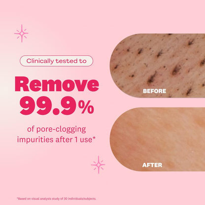 Soralise™ Brightening Facial Soap