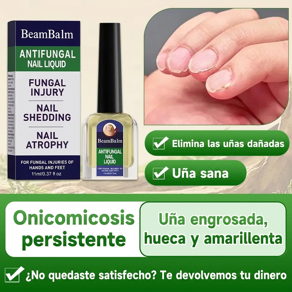 Soralise™ — Solución Antifúngica de Triple Acción