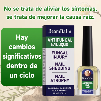 Soralise™ — Solución Antifúngica de Triple Acción